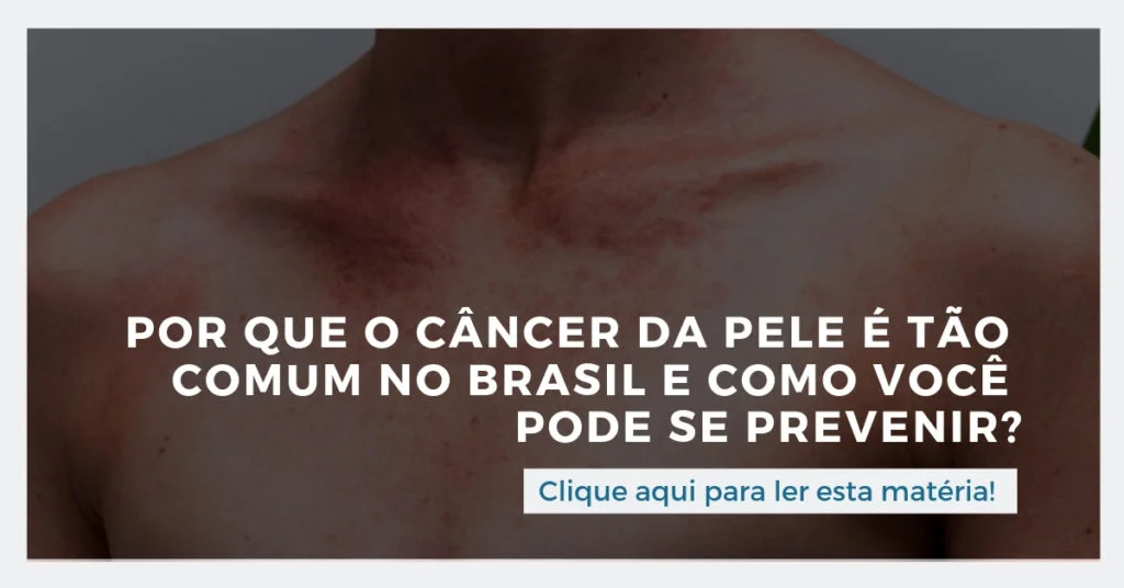 Clique aqui para ler esta matéria: Por que o câncer da pele é tão comum no Brasil e como você pode se prevenir?