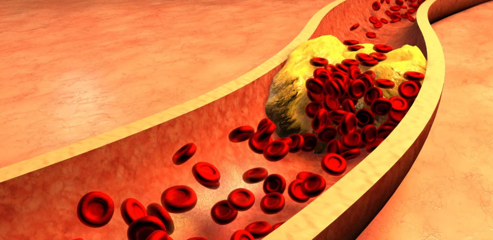 Saiba o que é o colesterol e como mantê-lo sob controle