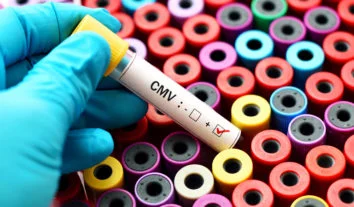 O exame para citomegalovírus deu positivo, e agora?