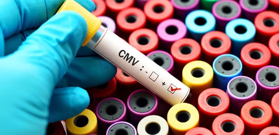 O exame para citomegalovírus deu positivo, e agora?